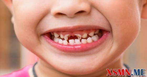 Nằm mơ thấy rụng răng đánh con gì