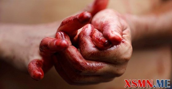 Chiêm bao mơ thấy máu là điềm báo gì