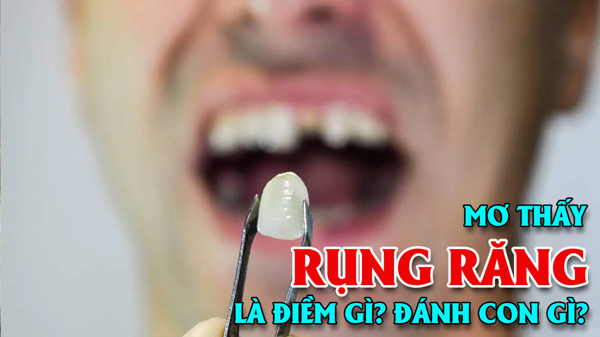 Giải mã giấc mơ thấy rụng răng, gãy răng