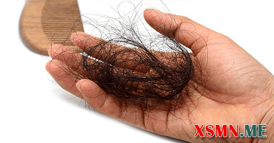Giải mộng chiêm bao bị rụng tóc